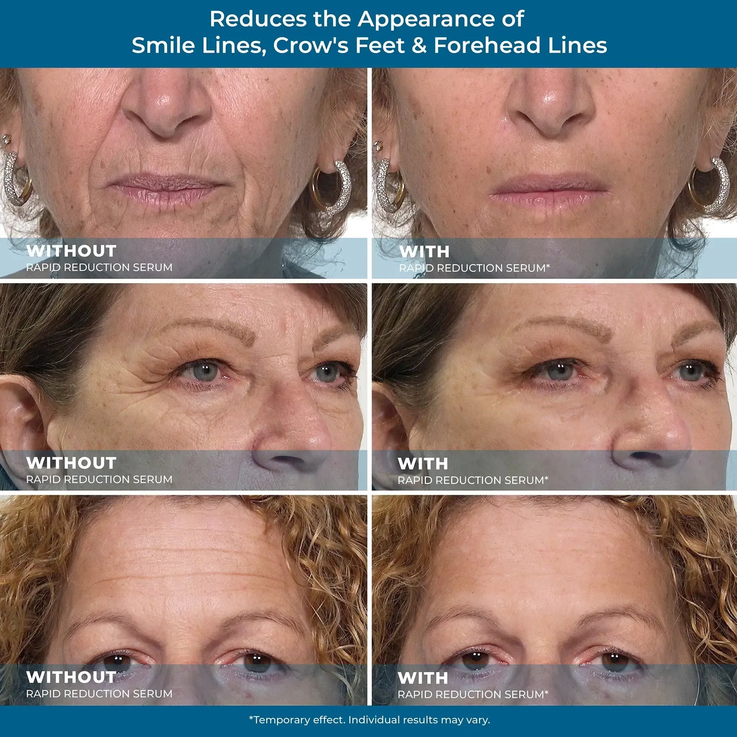 Plexaderm Rapid Reduction Serum ✨Instant Skin Firming & Lifting