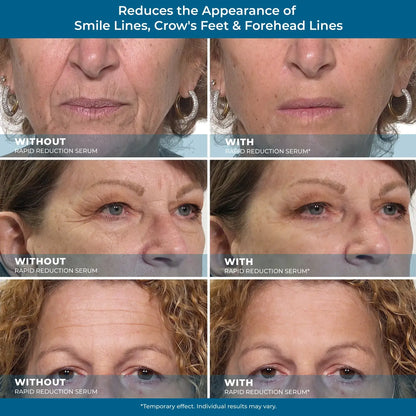 Plexaderm Rapid Reduction Serum ✨Instant Skin Firming & Lifting