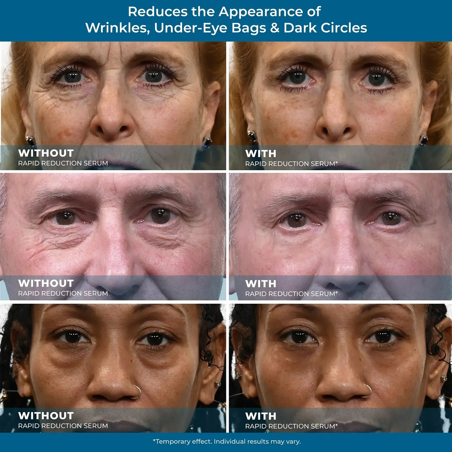 Plexaderm Rapid Reduction Serum ✨Instant Skin Firming & Lifting