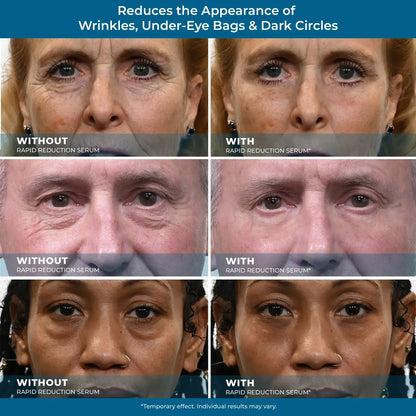 Plexaderm Rapid Reduction Serum ✨Instant Skin Firming & Lifting